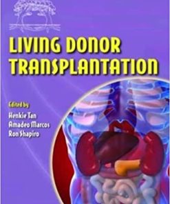 Living Donor Transplantation