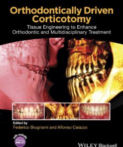 Orthodontically Driven Corticotomy Tissue Engineering to Enhance Orthodontic and Multidisciplinary Treatment