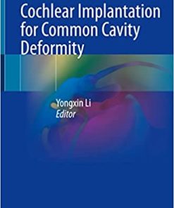 Cochlear Implantation for Common Cavity Deformity