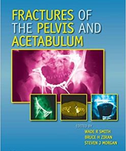 Fractures of the Pelvis and Acetabulum