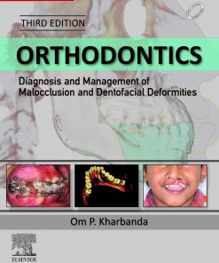 Orthodontics Diagnosis and Management of Malocclusion and Dentofacial Deformities