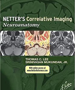 Netter’s Correlative Imaging Neuroanatomy