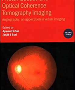 Photo Acoustic and Optical Coherence Tomography Imaging Volume 3 Angiography an application in vessel imaging