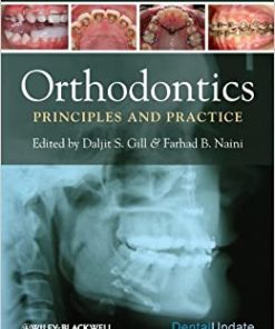 Orthodontics Principles And Practice