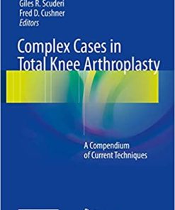 Complex Cases in Total Knee Arthroplasty A Compendium of Current Techniques
