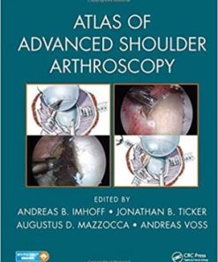 Atlas of Advanced Shoulder Arthroscopy