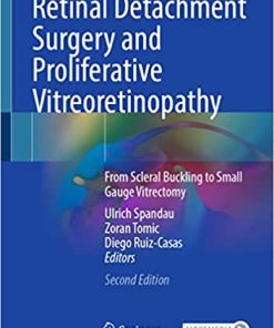 Retinal Detachment Surgery and Proliferative Vitreoretinopathy From Scleral Buckling to Small Gauge Vitrectomy 2nd Edition