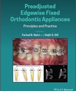 Preadjusted Edgewise Fixed Orthodontic Appliances Principles and Practice