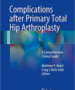 Complications after Primary Total Hip Arthroplasty A Comprehensive Clinical Guide