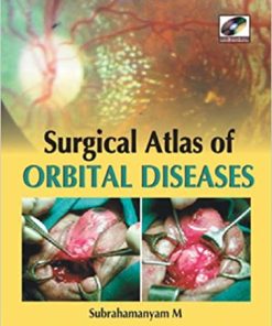 Surgical Atlas of Orbital Diseases