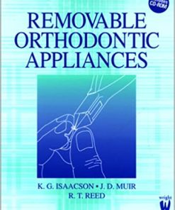Removable Orthodontic Appliances