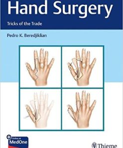 Hand Surgery Tricks of the Trade