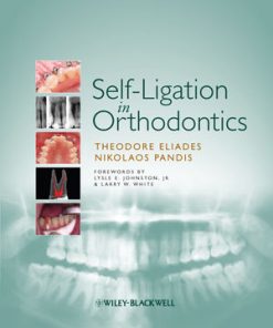 Self Ligation in Orthodontics