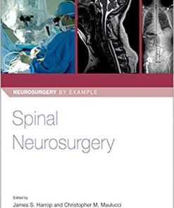 Spinal Neurosurgery