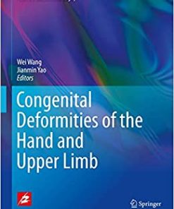 Congenital DeforCongenital Deformities of the Hand and Upper Limbmities of the Hand and Upper Limb