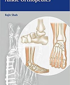 Handbook of Foot and Ankle Orthopedics