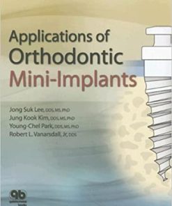 Applications of Orthodontic Mini Implants