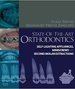 State Of The Art Orthodontics Self Ligating Appliances Miniscrews And Second Molars Extraction