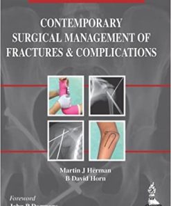 Contemporary Surgical Management of Fractures and Complications Pediatrics