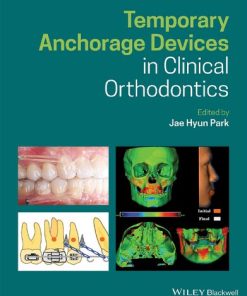 Temporary Anchorage Devices in Clinical Orthodontics