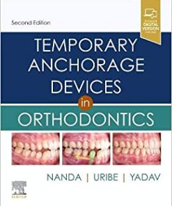 Temporary Anchorage Devices in Orthodontics 2nd Edition