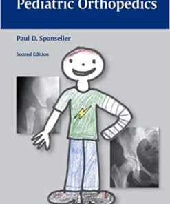Handbook of Pediatric Orthopedics 2nd Edition