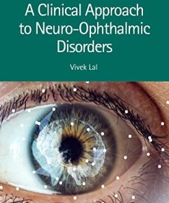 A Clinical Approach to Neuro Ophthalmic Disorders
