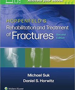 Hoppenfelds Treatment and Rehabilitation of Fractures 2nd Edition