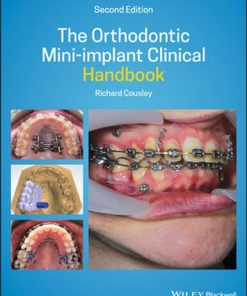 The Orthodontic Mini implant Clinical Handbook 2nd Edition