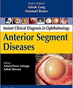 Anterior Segment Diseases