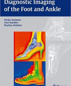 Diagnostic Imaging of the Foot and Ankle