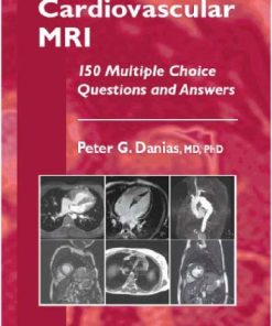 Cardiovascular MRI 150 Multiple Choice Questions and Answers