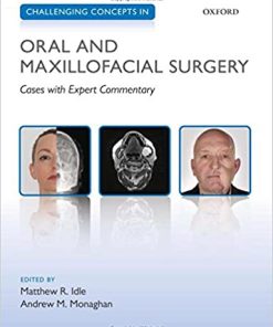 Challenging Concepts in Oral and Maxillofacial Surgery Cases with Expert Commentary