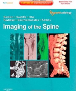 Imaging of the Spine