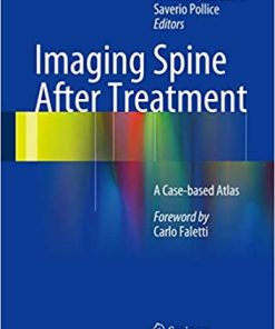 Imaging Spine After Treatment A Case Based Atlas