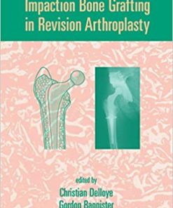 Impaction Bone Grafting in Revision Arthroplasty