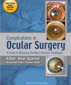 Complications in Ocular Surgery A Guide to Managing the Most Common Challenges