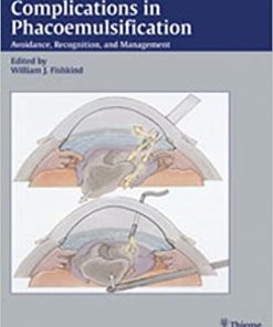 Complications in Phacoemulsification Avoidance Recognition and Management
