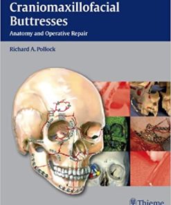Craniomaxillofacial Buttresses Anatomy and Operative Repair