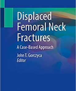 Displaced Femoral Neck Fractures A Case Based Approach