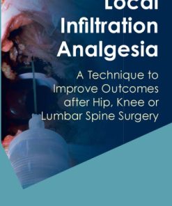 Local Infiltration Analgesia A Technique to Improve Outcomes After Hip Knee or Lumbar Spine Surgery
