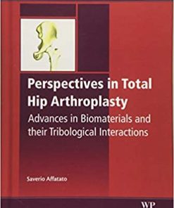 Perspectives in Total Hip Arthroplasty Advances in Biomaterials and their Tribological Interactions