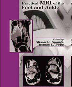 Practical MRI of the Foot and Ankle
