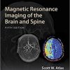 Magnetic Resonance Imaging of the Brain and Spine 5th Edition