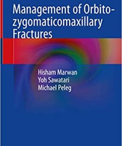 Management of Orbito Zygomaticomaxillary Fractures
