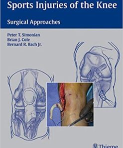 Sports Injuries of the Knee Surgical Approaches