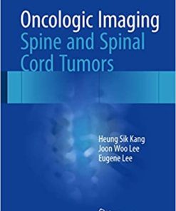 Oncologic Imaging Spine and Spinal Cord Tumors