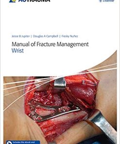 Manual of Fracture Management Wrist