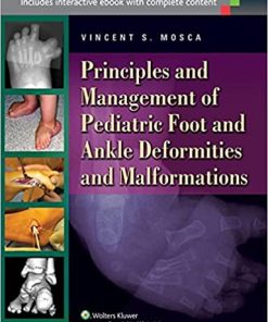 Principles and Management of Pediatric Foot and Ankle Deformities and Malformations