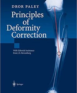 Principles of Deformity Correction